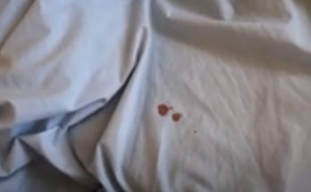 Remove Blood Stains from Sheets